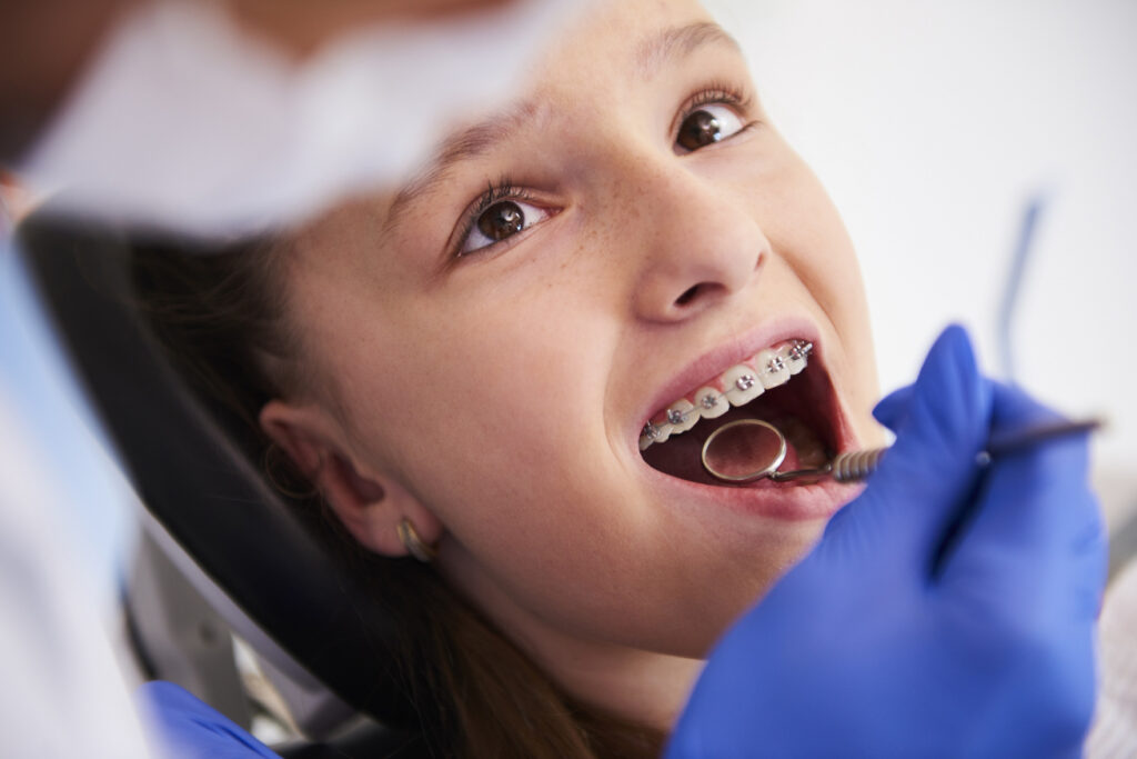Gyermek fogszabályozás - Forest&Ray Dental
