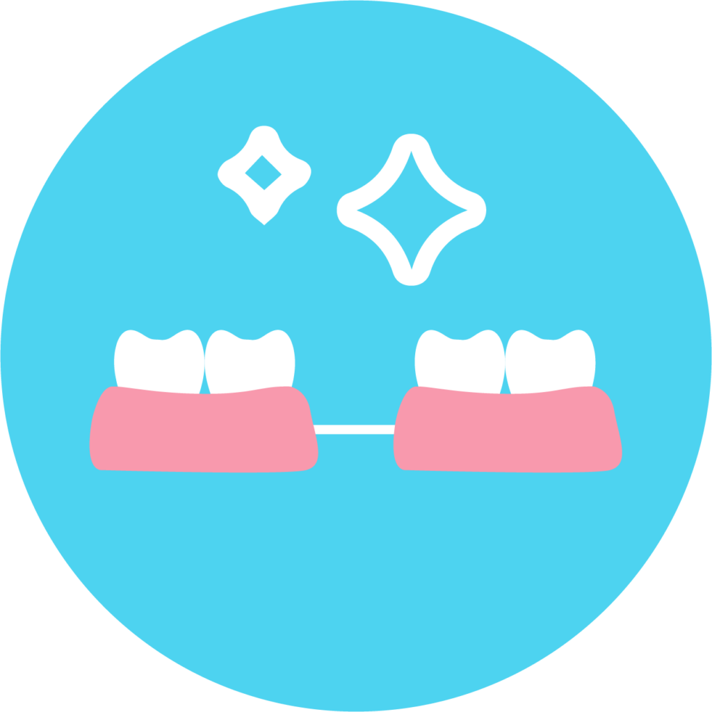 Fogpótlás fajtái - Rögzített fogsor, fogászati implantátum - FR Dental