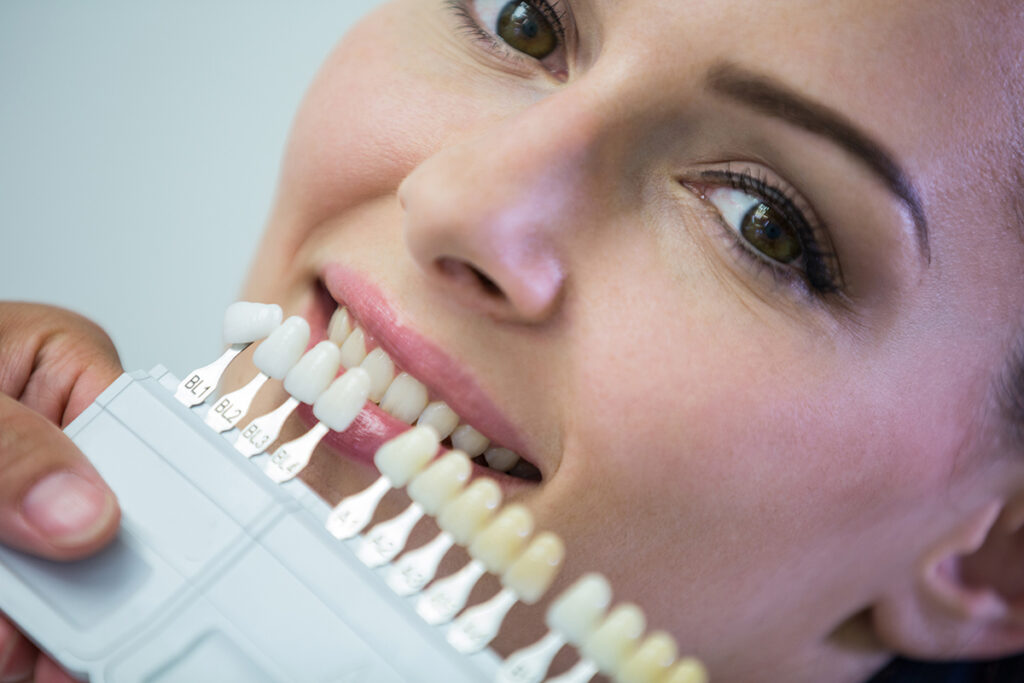 Mit tehetünk a fogak elszíneződése ellen?